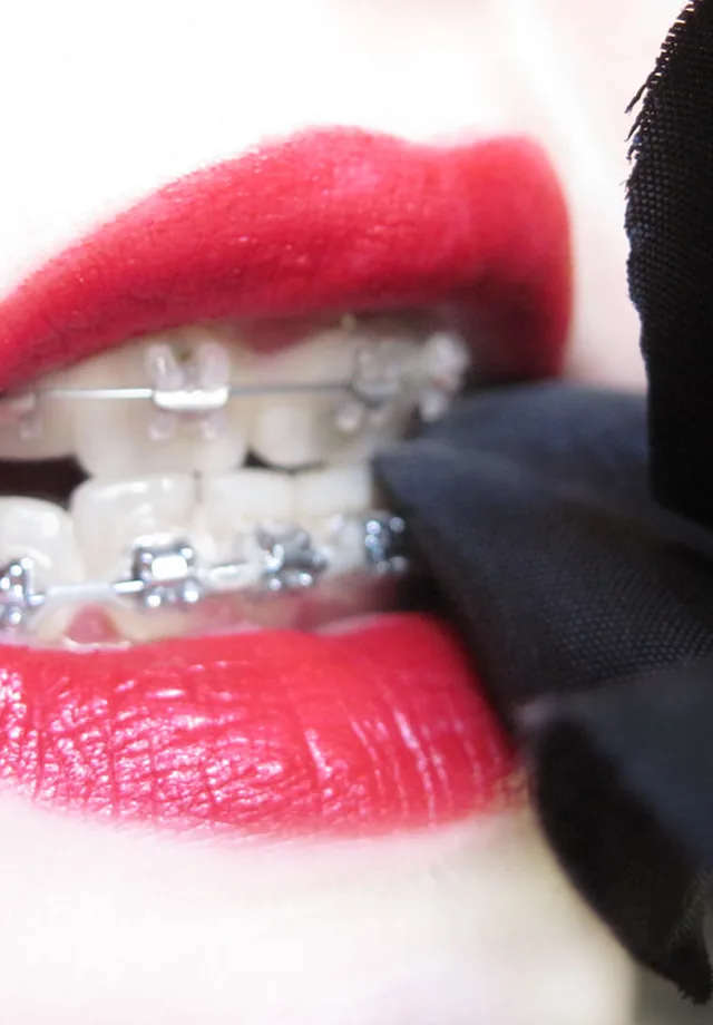 Pre-restorative setup - 3x