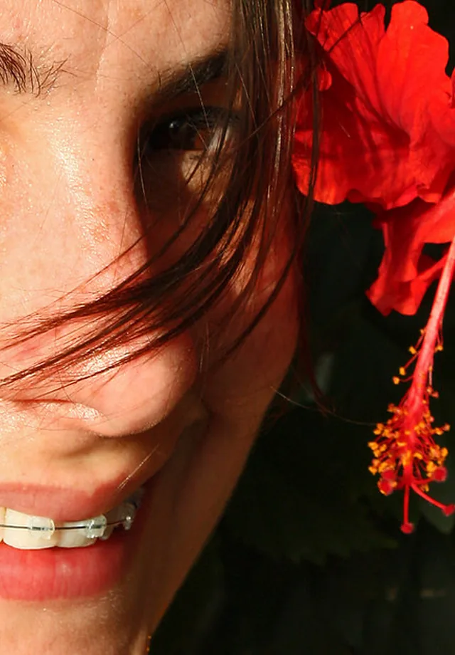 Smile design finish - 1x